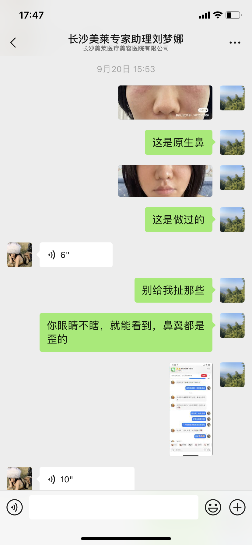 投诉长沙美莱医疗美容医院 虚假宣传 夸大疗效 服务内容欺诈